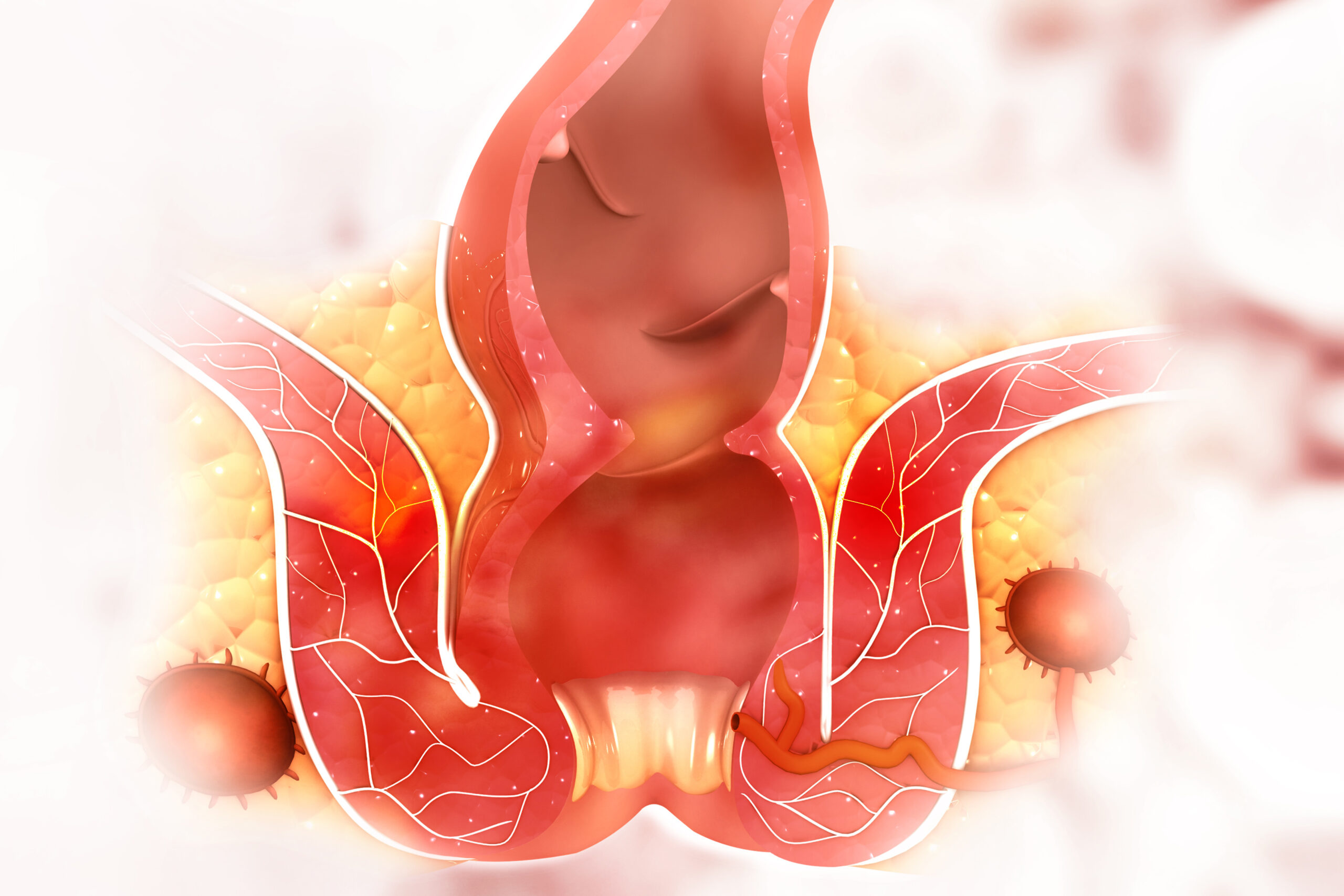 Αιμορροΐδες κατά τη διάρκεια της εγκυμοσύνης