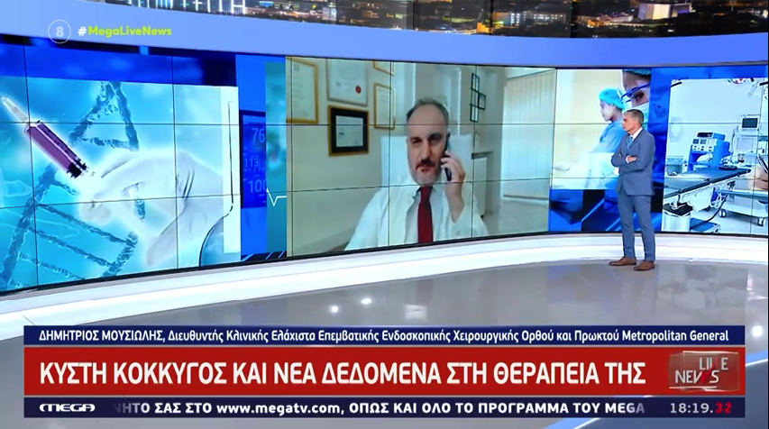 Ο Γενικός Χειρουργός Πρωκτολόγος Δρ. Δημήτρης Μουσιώλης μιλάει στην εκπομπή «Live News» του MEGA για την Κύστη Κόκκυγος και τα νέα δεδομένα για τη θεραπεία της
